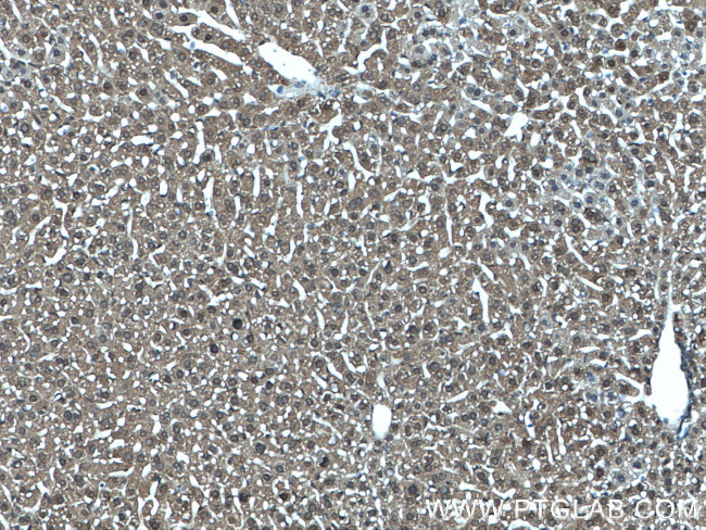 MTAP Antibody in Immunohistochemistry (Paraffin) (IHC (P))