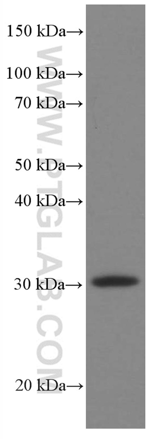 MTAP Antibody in Western Blot (WB)