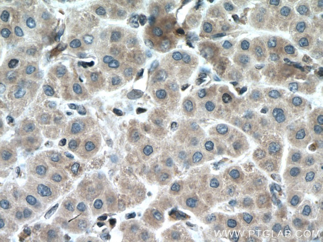 MTAP Antibody in Immunohistochemistry (Paraffin) (IHC (P))
