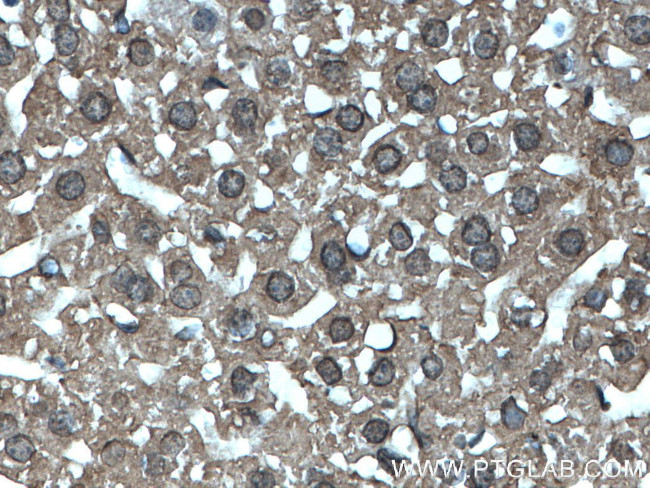 MTAP Antibody in Immunohistochemistry (Paraffin) (IHC (P))