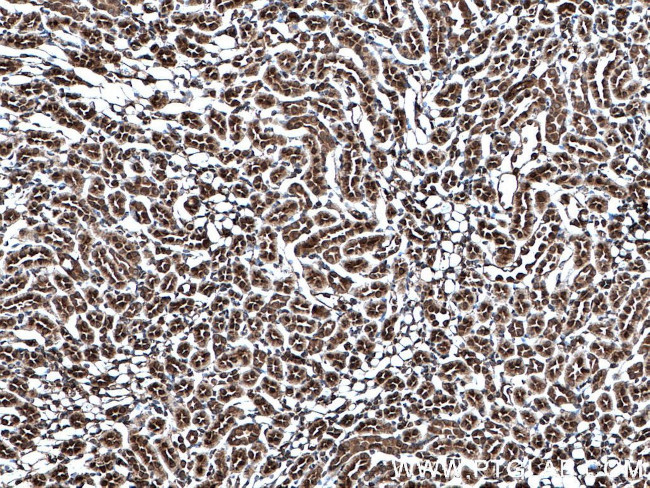 MTAP Antibody in Immunohistochemistry (Paraffin) (IHC (P))