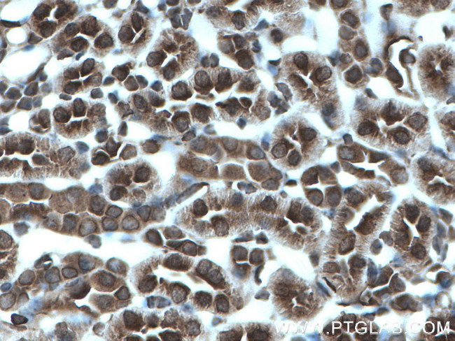 MTAP Antibody in Immunohistochemistry (Paraffin) (IHC (P))