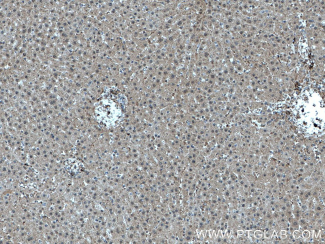 MTAP Antibody in Immunohistochemistry (Paraffin) (IHC (P))