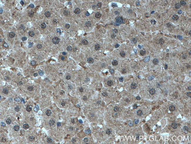 MTAP Antibody in Immunohistochemistry (Paraffin) (IHC (P))