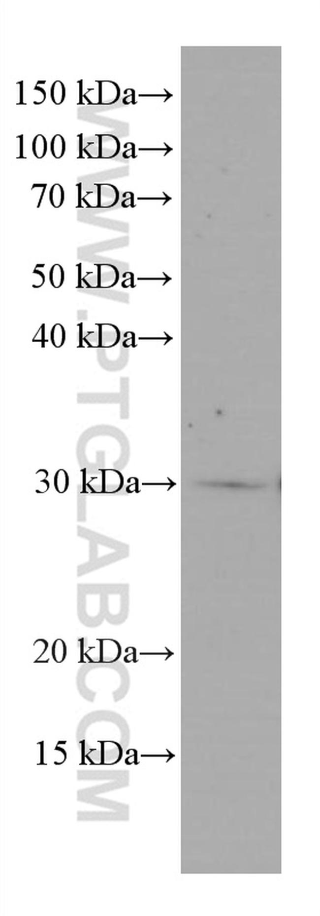 MTAP Antibody in Western Blot (WB)