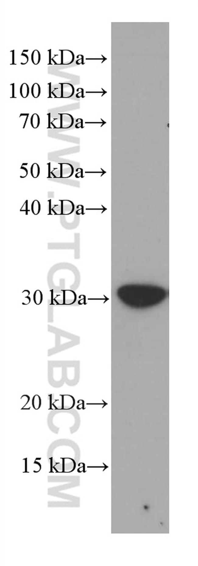 MTAP Antibody in Western Blot (WB)