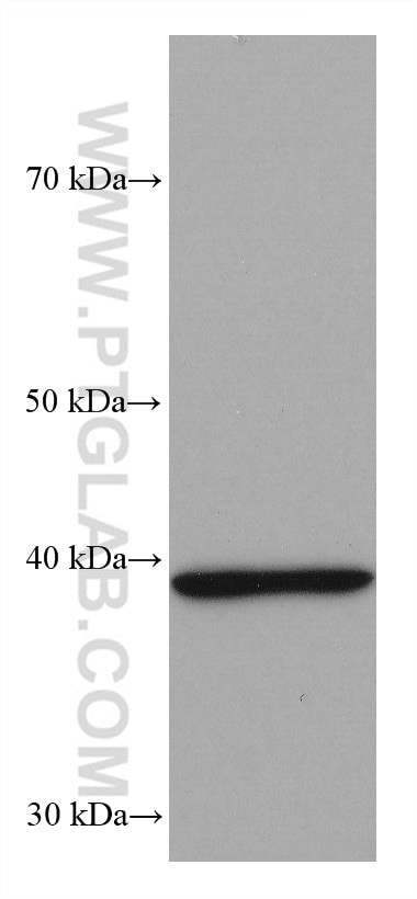 CD57 Antibody in Western Blot (WB)