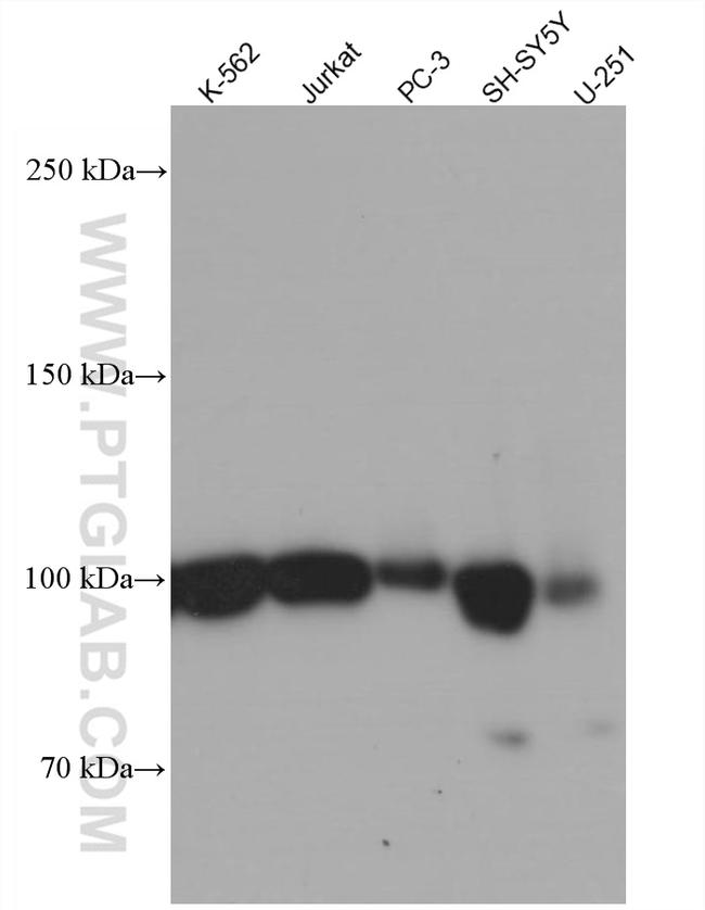 CD57 Antibody in Western Blot (WB)