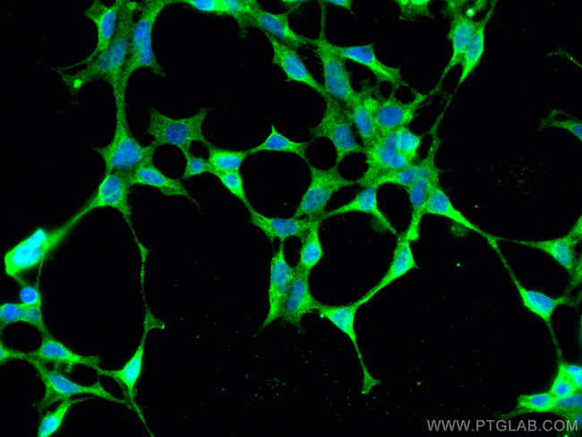 STRAP Antibody in Immunocytochemistry (ICC/IF)