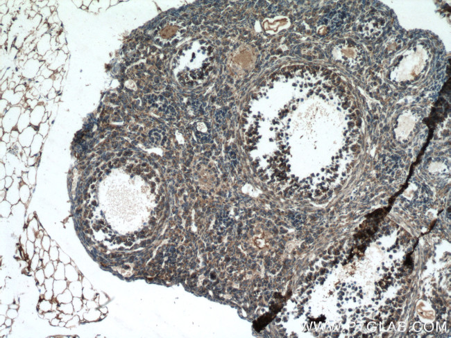 STRAP Antibody in Immunohistochemistry (Paraffin) (IHC (P))