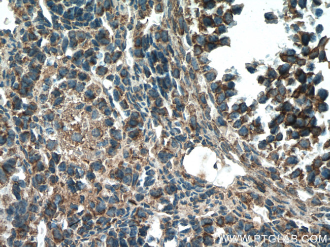 STRAP Antibody in Immunohistochemistry (Paraffin) (IHC (P))