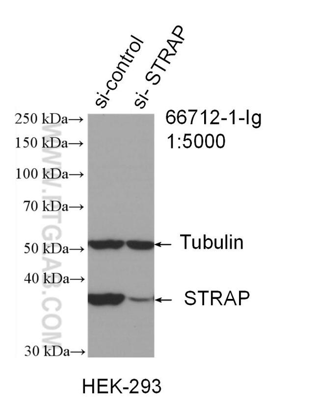 STRAP Antibody in Western Blot (WB)