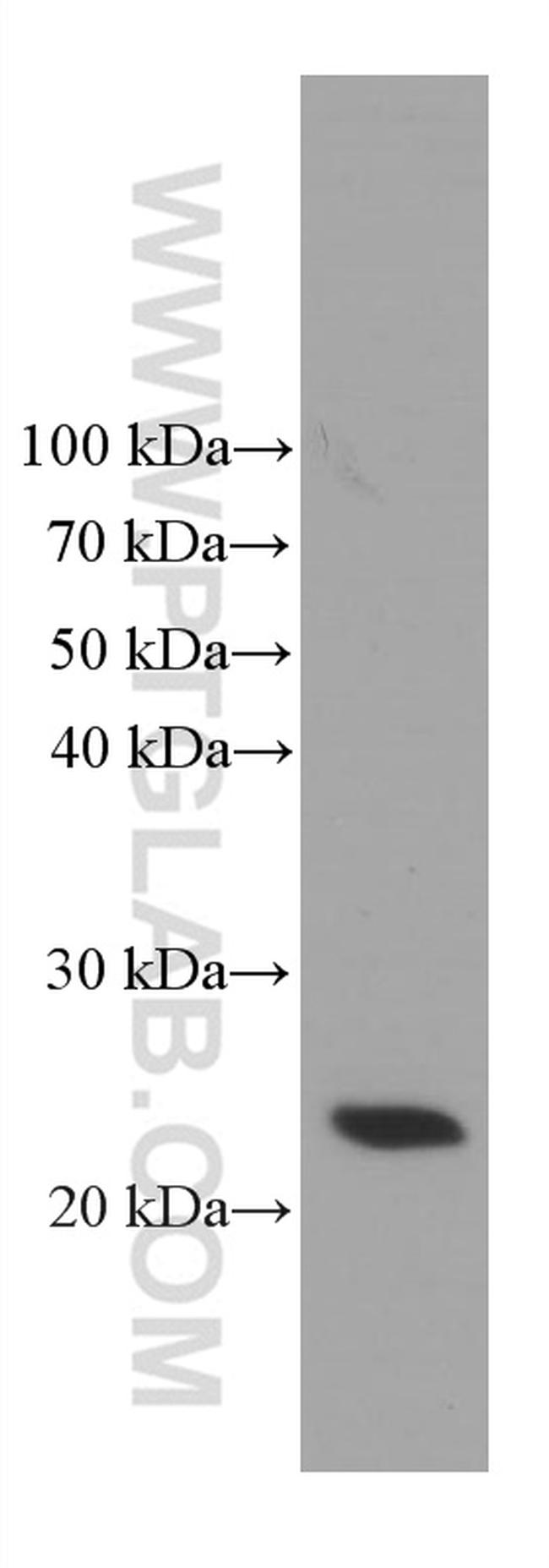 TPT1 Antibody in Western Blot (WB)