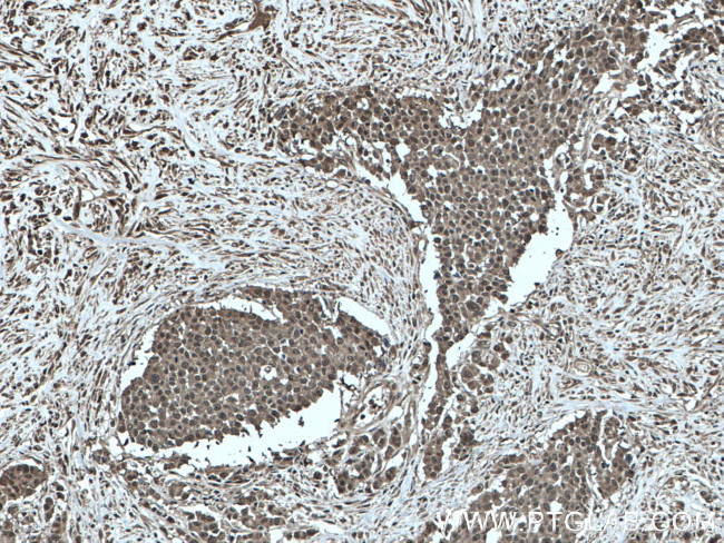 GSTP1 Antibody in Immunohistochemistry (Paraffin) (IHC (P))