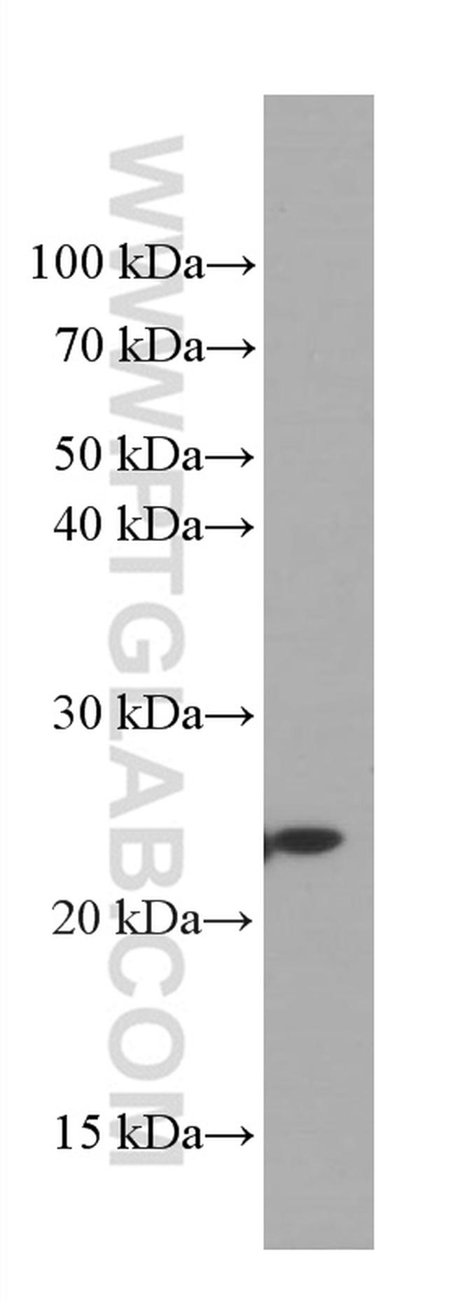 GSTP1 Antibody in Western Blot (WB)