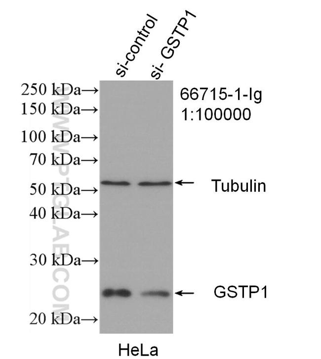 GSTP1 Antibody in Western Blot (WB)