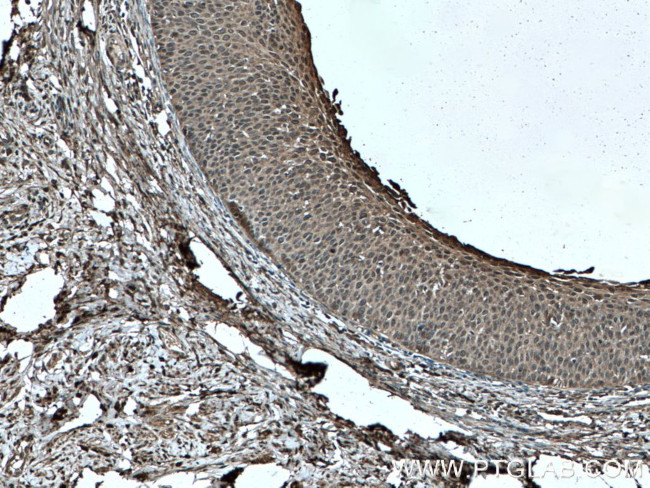 GSTP1 Antibody in Immunohistochemistry (Paraffin) (IHC (P))