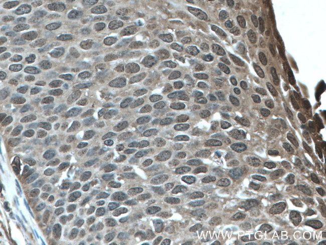 GSTP1 Antibody in Immunohistochemistry (Paraffin) (IHC (P))