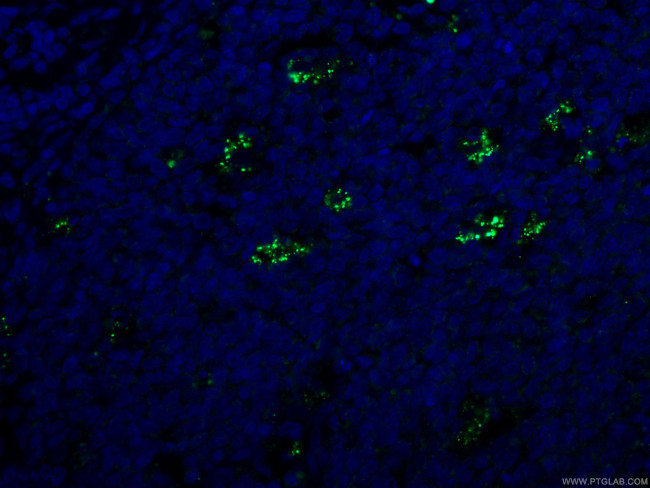 SYK Antibody in Immunohistochemistry (PFA fixed) (IHC (PFA))