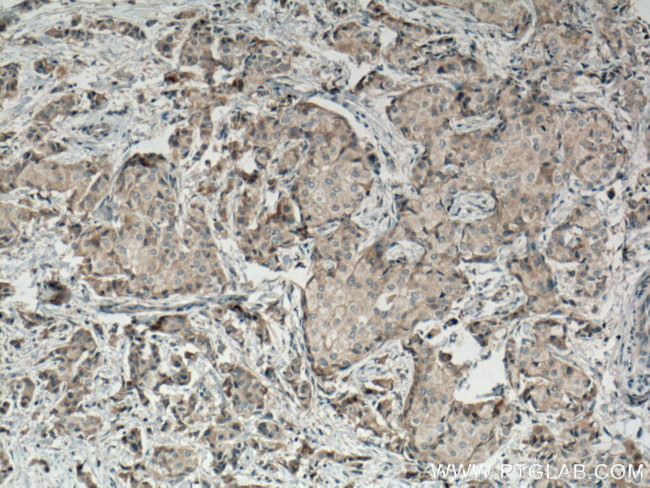 MRPS27 Antibody in Immunohistochemistry (Paraffin) (IHC (P))