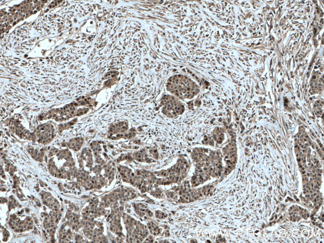 TYMS Antibody in Immunohistochemistry (Paraffin) (IHC (P))