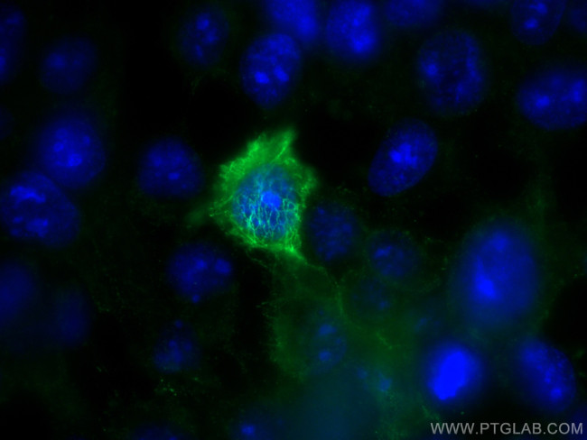 Cytokeratin 5 Antibody in Immunocytochemistry (ICC/IF)