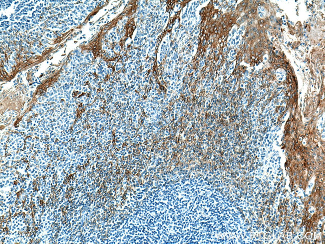 Cytokeratin 5 Antibody in Immunohistochemistry (Paraffin) (IHC (P))