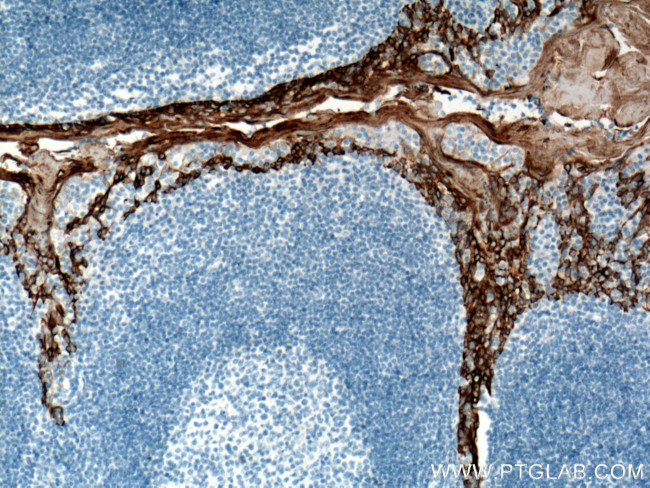 Cytokeratin 5 Antibody in Immunohistochemistry (Paraffin) (IHC (P))