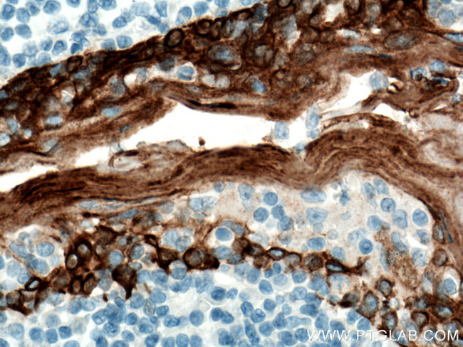 Cytokeratin 5 Antibody in Immunohistochemistry (Paraffin) (IHC (P))