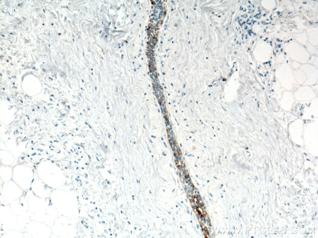 Cytokeratin 5 Antibody in Immunohistochemistry (Paraffin) (IHC (P))