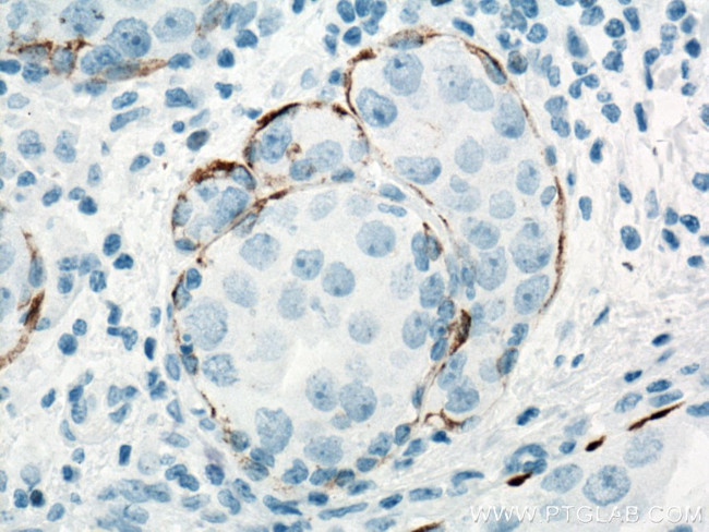 Cytokeratin 5 Antibody in Immunohistochemistry (Paraffin) (IHC (P))