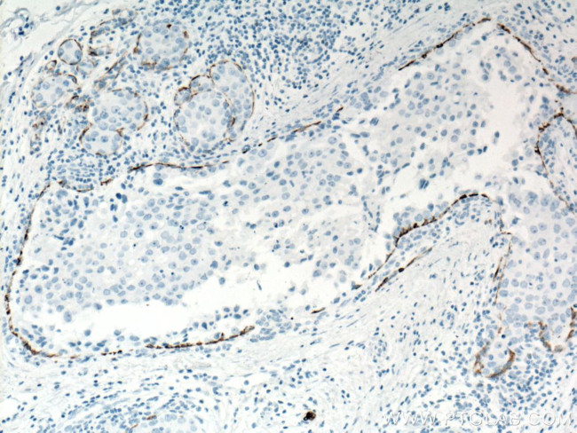 Cytokeratin 5 Antibody in Immunohistochemistry (Paraffin) (IHC (P))