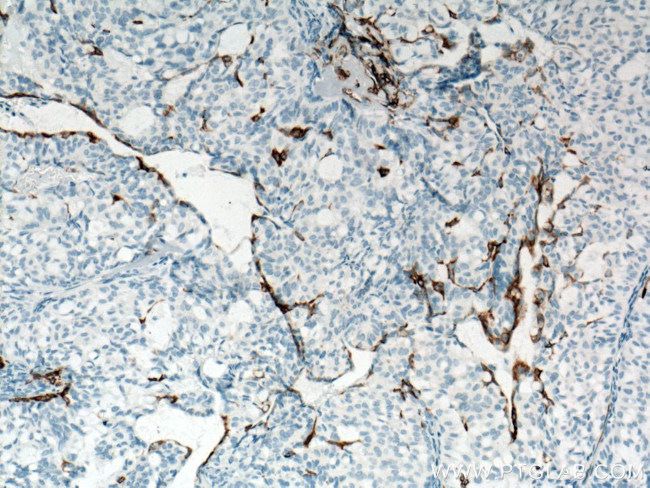 Cytokeratin 5 Antibody in Immunohistochemistry (Paraffin) (IHC (P))