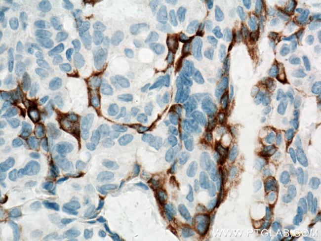 Cytokeratin 5 Antibody in Immunohistochemistry (Paraffin) (IHC (P))