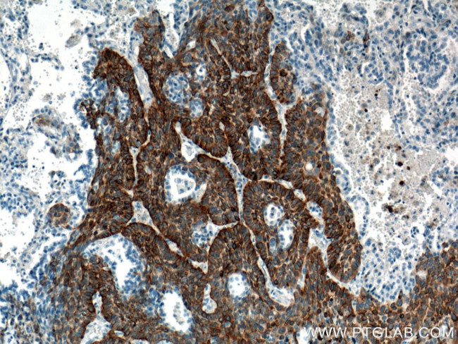 Cytokeratin 5 Antibody in Immunohistochemistry (Paraffin) (IHC (P))