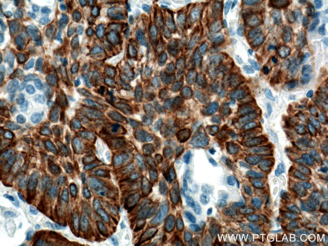 Cytokeratin 5 Antibody in Immunohistochemistry (Paraffin) (IHC (P))