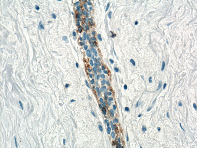 Cytokeratin 5 Antibody in Immunohistochemistry (Paraffin) (IHC (P))