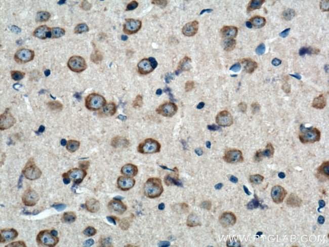 CNPase Antibody in Immunohistochemistry (Paraffin) (IHC (P))