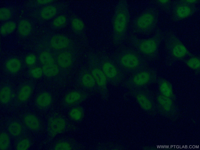 ARNT/HIF1B Antibody in Immunocytochemistry (ICC/IF)