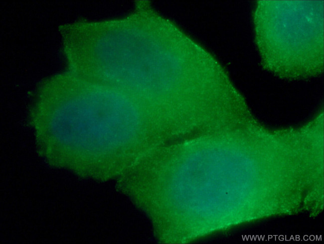 RHOA Antibody in Immunocytochemistry (ICC/IF)