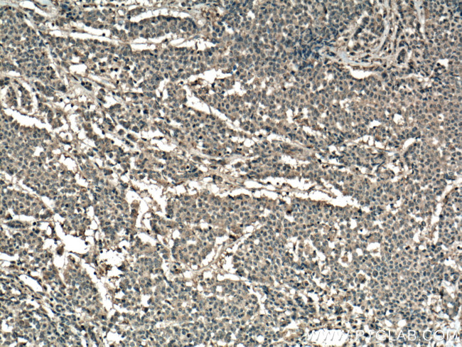 RHOA Antibody in Immunohistochemistry (Paraffin) (IHC (P))