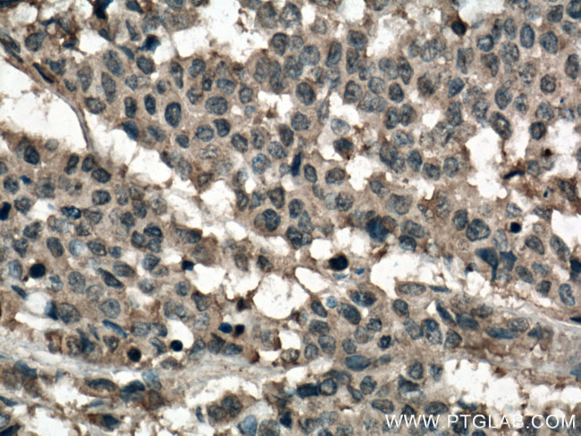 RHOA Antibody in Immunohistochemistry (Paraffin) (IHC (P))