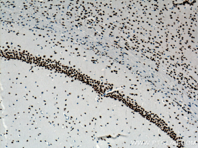 TDP-43 Antibody in Immunohistochemistry (Paraffin) (IHC (P))