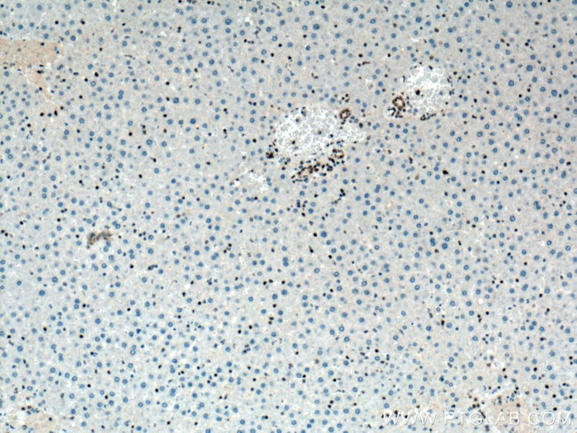 TDP-43 Antibody in Immunohistochemistry (Paraffin) (IHC (P))