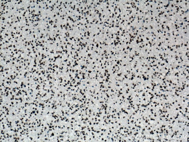 TDP-43 Antibody in Immunohistochemistry (Paraffin) (IHC (P))