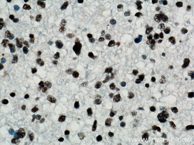 TDP-43 Antibody in Immunohistochemistry (Paraffin) (IHC (P))