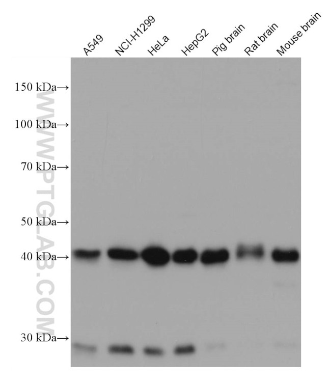 Dystroglycan Antibody in Western Blot (WB)