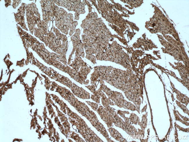 Dystroglycan Antibody in Immunohistochemistry (Paraffin) (IHC (P))