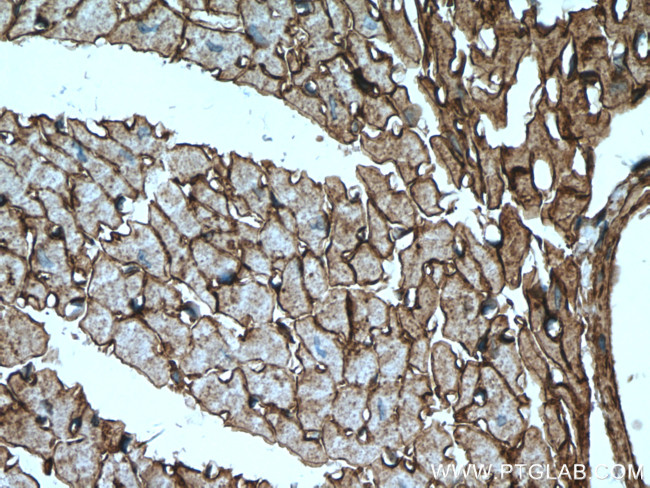 Dystroglycan Antibody in Immunohistochemistry (Paraffin) (IHC (P))