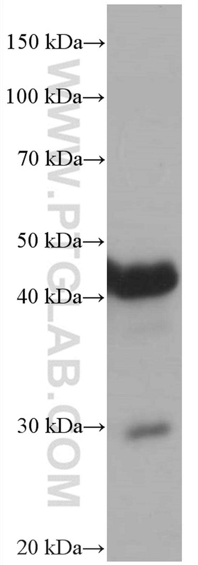 Dystroglycan Antibody in Western Blot (WB)